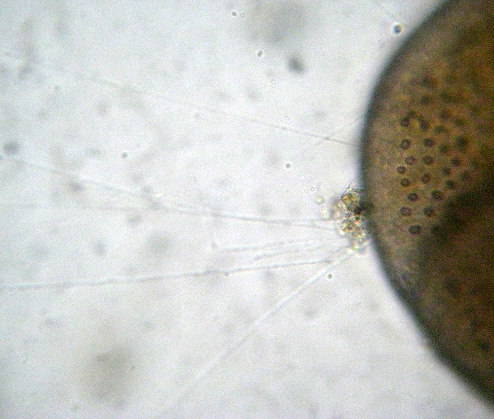 Foraminifera: verosimile Planorbulina variabilis